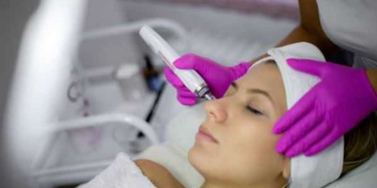 Microneedling in Tucson: What You Need to Know