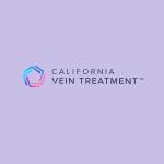 Vein Treatment California